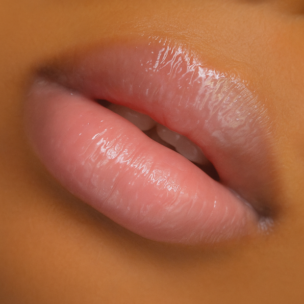 I&